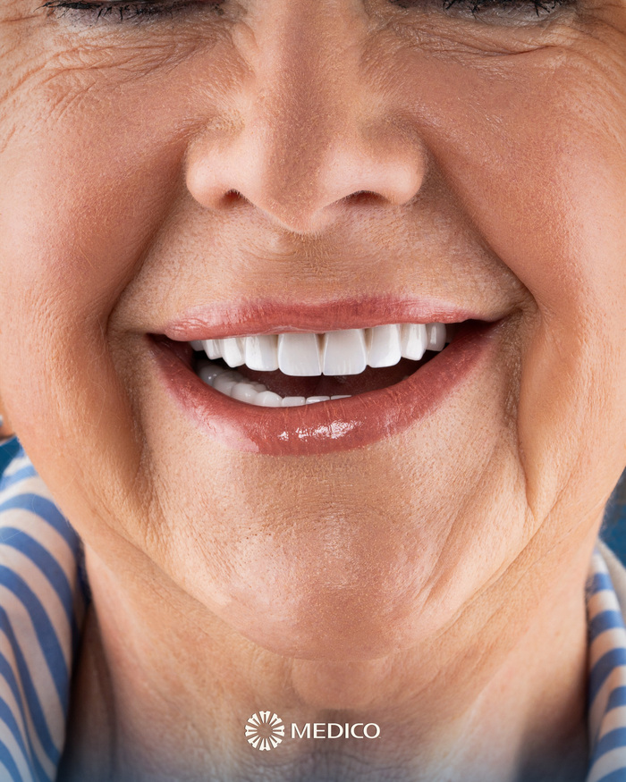 Before After Turkey Dental Surgery